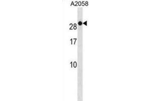 Western Blotting (WB) image for anti-RAB7B, Member RAS Oncogene Family (RAB7B) antibody (ABIN3001226) (RAB7B 抗体)