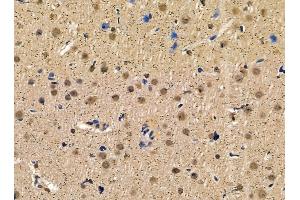 ABIN7095427 and ABIN7099484 at 1/100 staining rat brain tissue by IHC-P.