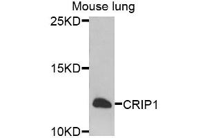 Western blot analysis of extracts of mouse lung, using CRIP1 antibody. (CRIP1 抗体  (AA 1-77))