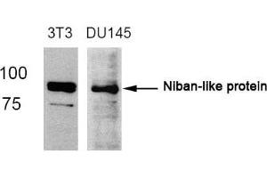 Western blot analysis of extracts from 3T3 and DU145 cells using Niban-like protein(Ab-712) antibody. (MEG3 抗体)