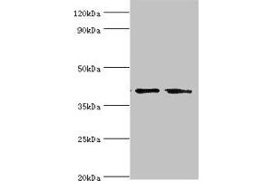 Western blot All lanes: LGALS9 antibody at 14 μg/mL Lane 1: Hela whole cell lysate Lane 2: Jurkat whole cell lysate Secondary Goat polyclonal to rabbit IgG at 1/10000 dilution Predicted band size: 40, 36, 35, 27, 26, 39 kDa Observed band size: 40 kDa (Galectin 9 抗体  (AA 1-240))