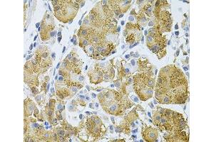 Immunohistochemistry of paraffin-embedded Human stomach using PLCG1 Polyclonal Antibody at dilution of 1:100 (40x lens). (Phospholipase C gamma 1 抗体)