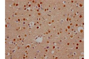 IHC image of ABIN7127644 diluted at 1:100 and staining in paraffin-embedded human brain tissue performed on a Leica BondTM system. (Recombinant Notch1 抗体)