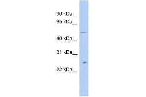 WB Suggested Anti-TTC8 Antibody Titration:  0. (TTC8 抗体  (N-Term))