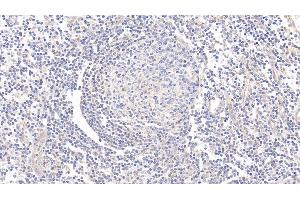 Detection of CD73 in Human Tonsil Tissue using Polyclonal Antibody to Cluster Of Differentiation 73 (CD73) (CD73 抗体  (AA 29-500))