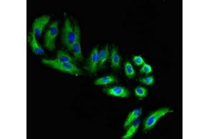 Immunofluorescence (IF) image for anti-FERM, RhoGEF (ARHGEF) and Pleckstrin Domain Protein 1 (Chondrocyte-Derived) (FARP1) (AA 1-300) antibody (ABIN7152690)