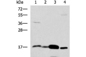 Western blot analysis of Mouse Pancreas tissue Mouse small intestines tissue Mouse large intestine tissue Human sigmoid tissue lysates using ZG16 Polyclonal Antibody at dilution of 1:1350 (ZG16 抗体)