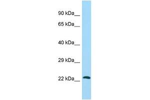 Host: Rabbit Target Name: ATG10 Sample Type: HepG2 Whole Cell lysates Antibody Dilution: 1. (ATG10 抗体  (C-Term))
