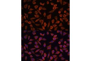 Immunofluorescence analysis of L929 cells using TSLP antibody (ABIN6128843, ABIN6149624, ABIN6149626 and ABIN6217014) at dilution of 1:100. (Thymic Stromal Lymphopoietin 抗体  (AA 29-159))