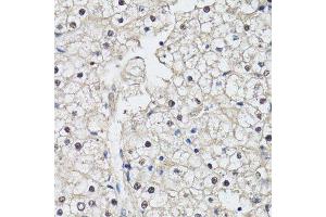 Immunohistochemistry of paraffin-embedded human liver using CDK7 antibody. (CDK7 抗体  (AA 211-346))