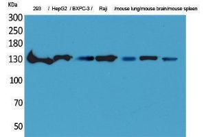 Western Blotting (WB) image for anti-Interleukin 16 (IL16) (C-Term) antibody (ABIN3178206) (IL16 抗体  (C-Term))