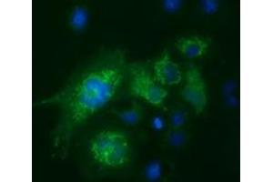 Anti-FAHD2A mouse monoclonal antibody (ABIN2453023) immunofluorescent staining of COS7 cells transiently transfected by pCMV6-ENTRY FAHD2A (RC211128). (FAHD2A 抗体)