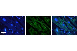 Rabbit Anti-CERS2 Antibody   Formalin Fixed Paraffin Embedded Tissue: Human heart Tissue Observed Staining: Plasma membrane in intercalated disk Primary Antibody Concentration: 1:100 Other Working Concentrations: N/A Secondary Antibody: Donkey anti-Rabbit-Cy3 Secondary Antibody Concentration: 1:200 Magnification: 20X Exposure Time: 0. (Ceramide Synthase 2 抗体  (N-Term))