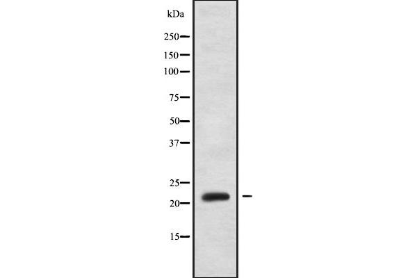 GAR1 抗体  (Internal Region)
