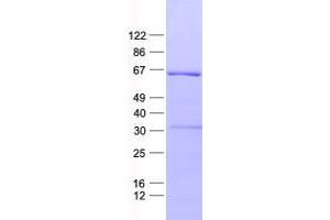 Western Blotting (WB) image for Zinc Finger Protein 426 (ZNF426) protein (His tag) (ABIN2736042)