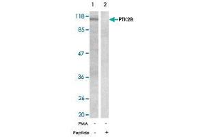 Western blot analysis of the extracts from Jurkat cells untreated or treated with PMA using PTK2B polyclonal antibody  .