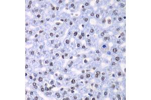 Immunohistochemistry (Paraffin-embedded Sections) (IHC (p)) image for anti-Splicing Factor 3b, Subunit 2, 145kDa (SF3B2) (AA 616-895) antibody (ABIN6147666)