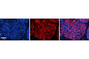 Rabbit Anti-SAAntibody   Formalin Fixed Paraffin Embedded Tissue: Human Testis Tissue Observed Staining: Cytoplasm in spermatogonia and spermatocytes Primary Antibody Concentration: N/A Other Working Concentrations: 1:600 Secondary Antibody: Donkey anti-Rabbit-Cy3 Secondary Antibody Concentration: 1:200 Magnification: 20X Exposure Time: 0. (SAP18 抗体  (N-Term))