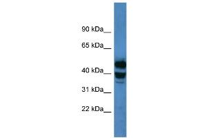 Western Blotting (WB) image for anti-Cytochrome P450, Family 21, Subfamily A, Polypeptide 2 (CYP21A2) (C-Term) antibody (ABIN2788351)