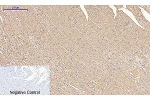 Immunohistochemical analysis of paraffin-embedded rat heart tissue. (IRS1 抗体)
