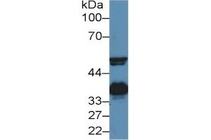 Western Blotting (WB) image for Haptoglobin (HP) ELISA Kit (ABIN6574214)