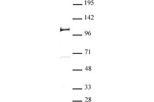 PHF20 antibody (pAb) tested by Western blot 20 μg nuclear extract of F9 retinoic acid -treated mouse teratocarcinoma stem cells probed with PHF20 antibody (1:500). (PHF20 抗体)
