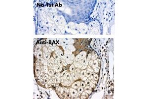 Immunohistochemistry (IHC) image for anti-BCL2-Associated X Protein (BAX) (N-Term) antibody (ABIN6254209) (BAX 抗体  (N-Term))