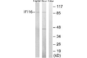 Western blot analysis of extracts from HeLa cells and HepG2 cells, using IFI16 antibody. (IFI16 抗体  (Internal Region))