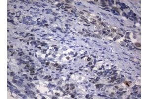 Image no. 2 for anti-Antigen Identified By Monoclonal Antibody Ki-67 (MKI67) (AA 1160-1493) antibody (ABIN1490860) (Ki-67 抗体  (AA 1160-1493))