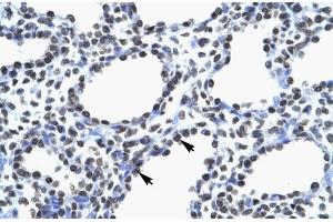 Human Lung; MYEF2 antibody - middle region in Human Lung cells using Immunohistochemistry (MYEF2 抗体  (Middle Region))