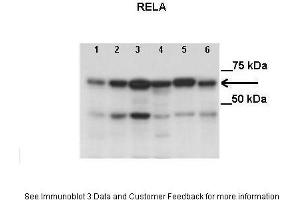 Lanes:   Lane1: 50 ug HCT116 cell lysate Lane2: 50 ug HT-29 cell lysate Lane3: 50 ug T47D cell lysate Lane4: 50 ug HEK-293T cell lysate Lane5: 50 ug MCF7 cell lysate Lane6: 50 ug MDA-MB-231 cell lysate  Primary Antibody Dilution:   2 ug/ml  Secondary Antibody:   Anti-Rabbit HRP  Secondary Antibody Dilution:     Gene Name:   RELA  Submitted by:   Anonymous