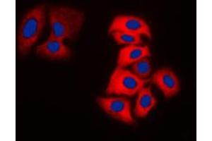 Immunofluorescent analysis of MOK staining in MDAMB231 cells. (MOK 抗体  (Center))