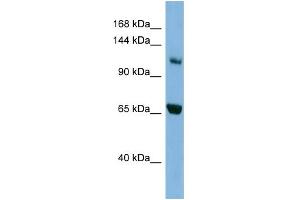WB Suggested Anti-MYO1E Antibody Titration: 0.