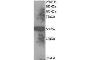 Image no. 1 for anti-Thioredoxin Domain Containing 5 (Endoplasmic Reticulum) (TXNDC5) (C-Term), (Isoform 1), (Isoform 3) antibody (ABIN374463) (TXNDC5 抗体  (C-Term, Isoform 1, Isoform 3))