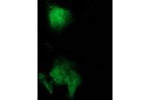 Anti-CAT mouse monoclonal antibody (ABIN2454281) immunofluorescent staining of COS7 cells transiently transfected by pCMV6-ENTRY CAT (RC210763).