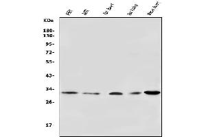 Western blot analysis of VDAC3 using anti-VDAC3 antibody (ABIN7602541).