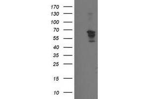 Western Blotting (WB) image for anti-Beclin 1, Autophagy Related (BECN1) antibody (ABIN1496865) (Beclin 1 抗体)