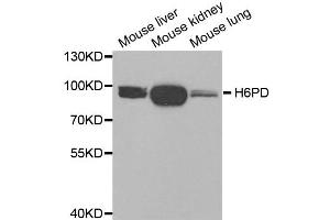 Western blot analysis of extracts of various tissues, using H6PD antibody. (Glucose-6-Phosphate Dehydrogenase 抗体)