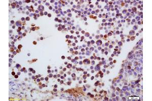 Formalin-fixed and paraffin embedded mouse colon carcinoma labeled with Anti-TdT/DNTT Polyclonal Antibody, Unconjugated (ABIN681973) at 1:200 followed by conjugation to the secondary antibody and DAB staining (TdT 抗体  (AA 351-450))