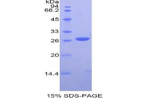 SDS-PAGE analysis of Mouse alpha Fodrin Protein. (SPTAN1 蛋白)