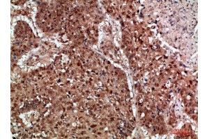 Immunohistochemistry (IHC) image for anti-Toll-Like Receptor Adaptor Molecule 1 (TICAM1) (AA 663-712) antibody (ABIN7189088)