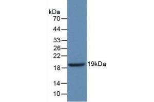 Western blot analysis of recombinant Human GbA. (GBA 抗体  (AA 334-498))