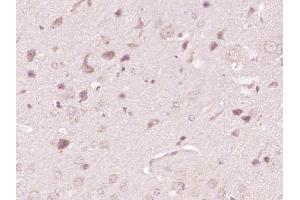 Paraformaldehyde-fixed, paraffin embedded mouse brain, Antigen retrieval by boiling in sodium citrate buffer (pH6) for 15min, Block endogenous peroxidase by 3% hydrogen peroxide for 30 minutes, Blocking buffer (normal goat serum) at 37°C for 20min, Antibody incubation with ATP7A Polyclonal Antibody, Unconjugated  at 1:400 overnight at 4°C, followed by a conjugated secondary and DAB staining.