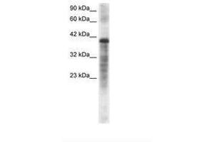 Image no. 2 for anti-Proteasome (Prosome, Macropain) 26S Subunit, ATPase, 3 (PSMC3) (AA 293-339) antibody (ABIN202439) (PSMC3 抗体  (AA 293-339))