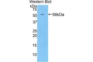 Western Blotting (WB) image for anti-P-Cadherin (CDH3) (AA 565-822) antibody (ABIN1858339) (P-Cadherin 抗体  (AA 565-822))