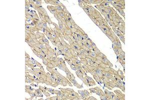 Immunohistochemistry of paraffin-embedded rat heart using SGCD antibody at dilution of 1:100 (x40 lens). (SGCD 抗体)