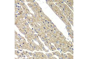 Immunohistochemistry of paraffin-embedded rat heart using SGCD antibody at dilution of 1:100 (x40 lens).