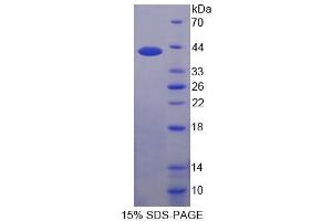 SDS-PAGE analysis of Human PIM3 Protein. (PIM3 蛋白)