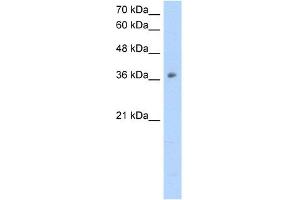 WB Suggested Anti-OTC Antibody Titration:  2. (OTC 抗体  (N-Term))