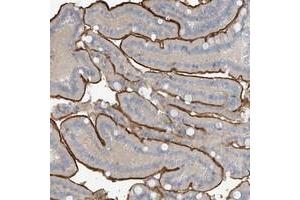 Immunohistochemical staining of human duodenum with ZNF793 polyclonal antibody  shows strong luminal membranous positivity in glandular cells at 1:200-1:500 dilution.